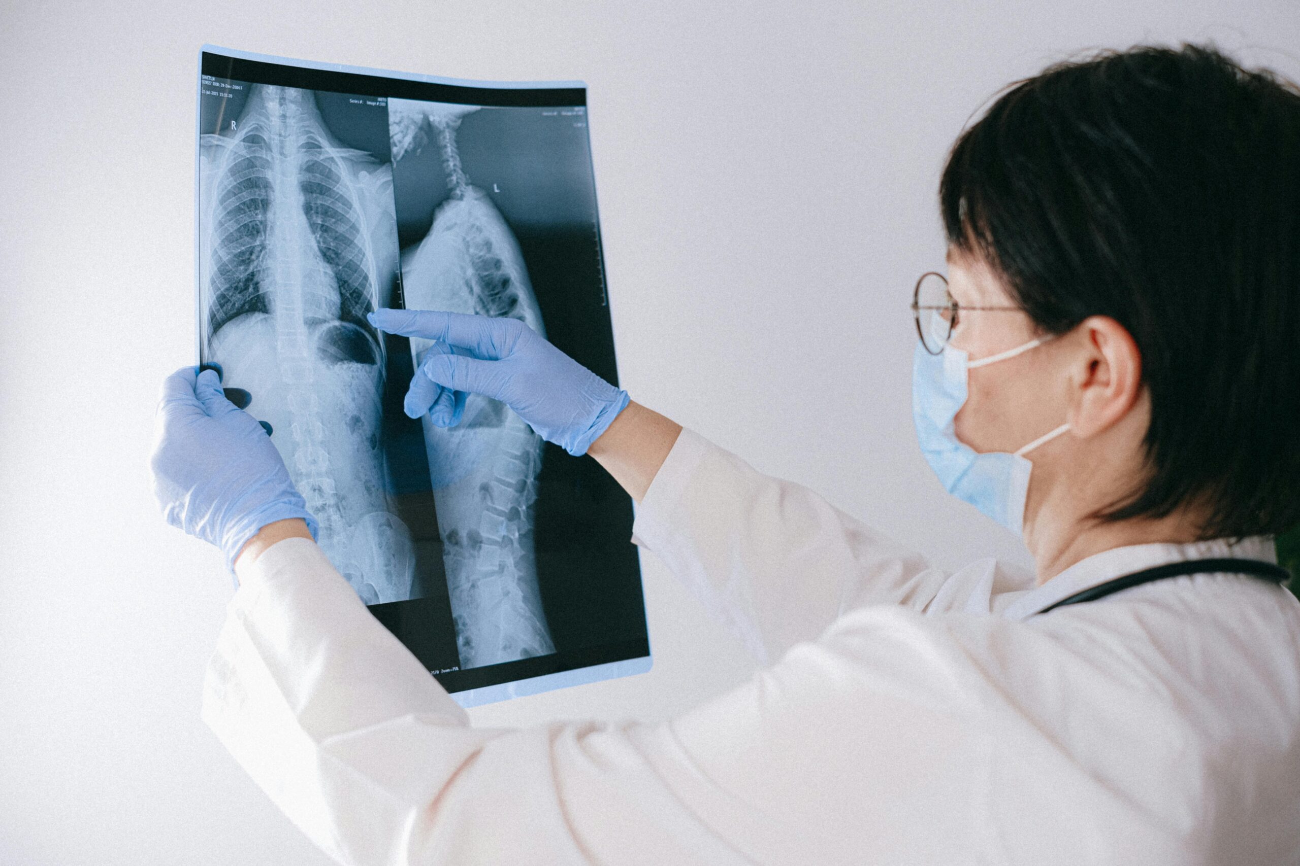 Read more about the article Is Scoliosis Hereditary?